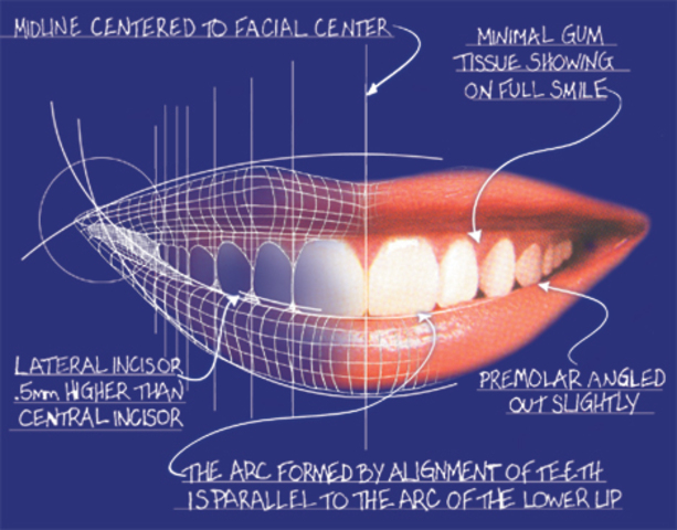 Finally got my braces OFF! :)