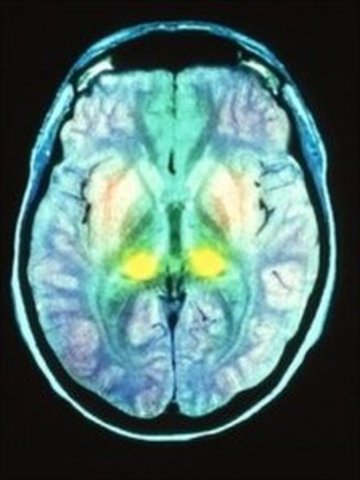 New medical diagnostic test