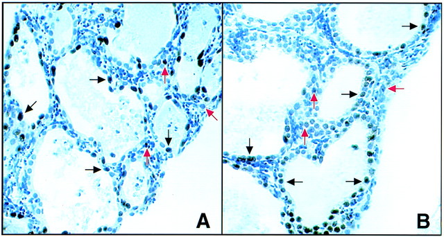 First Cloned Human Embryos