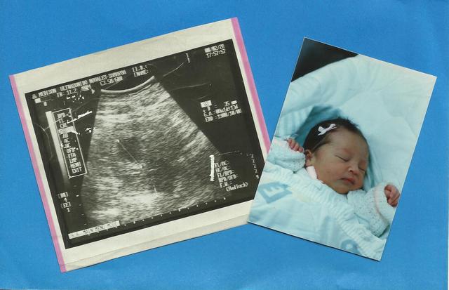 Mi primera hermana nace