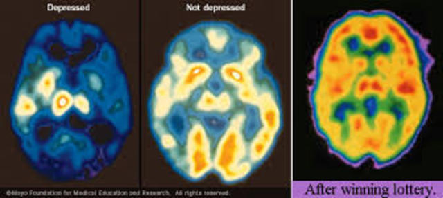 Was diagnosed with major psychotic depression.