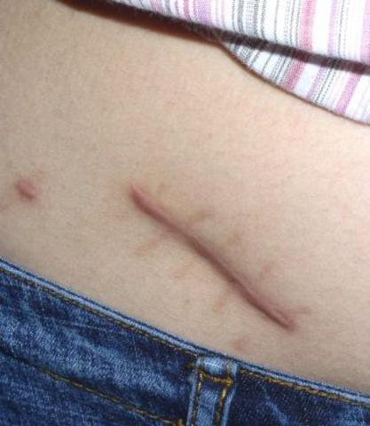 Intervención quirúrgica