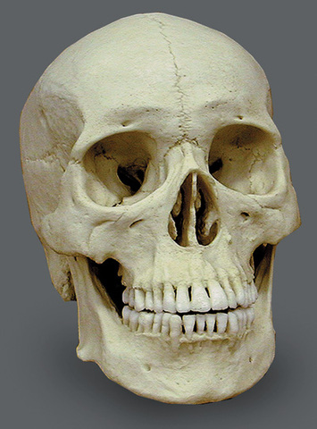 Death of Nicolas Vallet