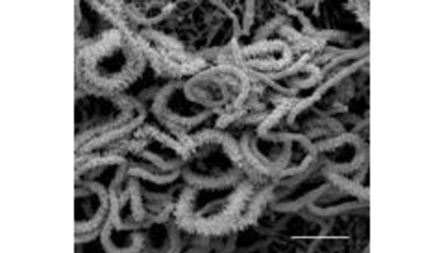 El genoma Saccharopolyspora erythraea