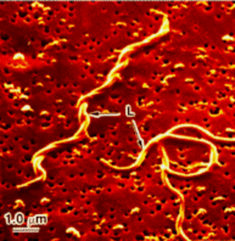 Hallazgo de bacterias en personas