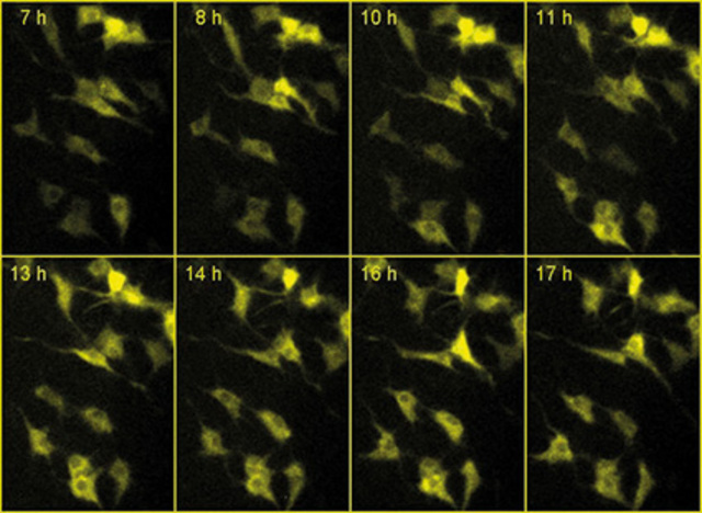 IMPROVING THE EXPOSURE TIME