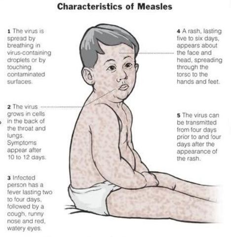 Saint Louis, Missouri