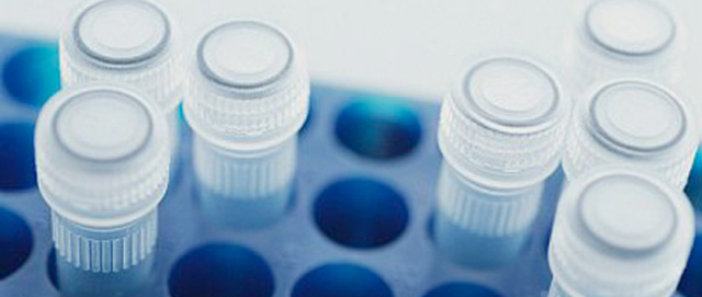 Discovery of proteins