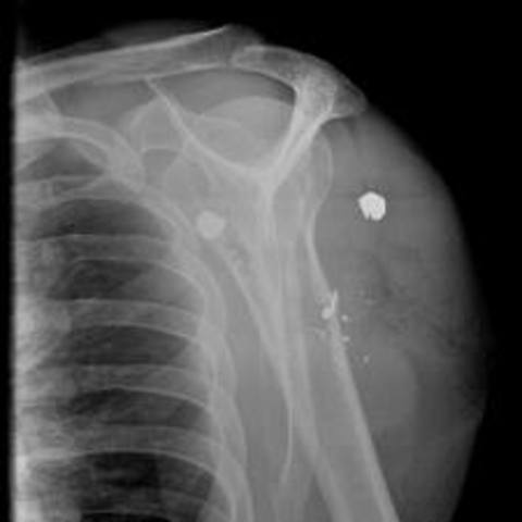 Shot in the arm in the army