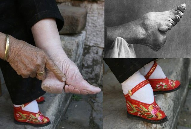 Footbinding Abolished in China