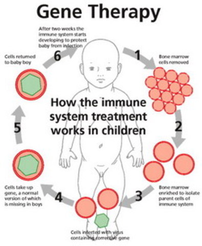 The first federally approved gene therapy treatment is performed successfully on a 4-yearold girl suffering from an immune disorder.