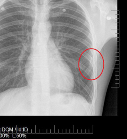 Rudys act of stupidity(2/3)