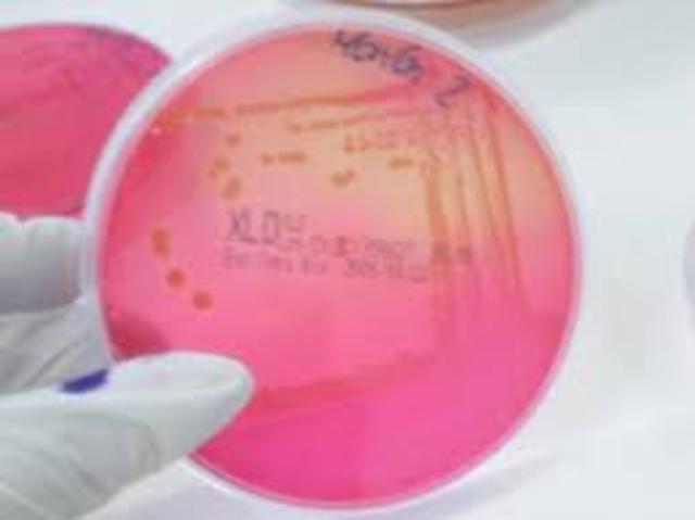 Introducción de los indicadores de PH en los medios de cultivo