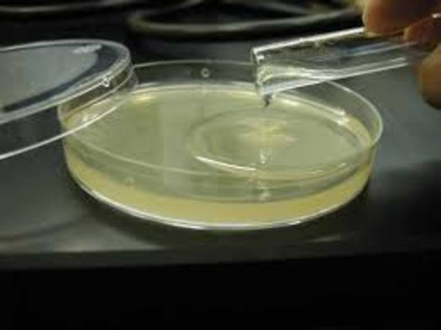 Utilizacion de agar agar