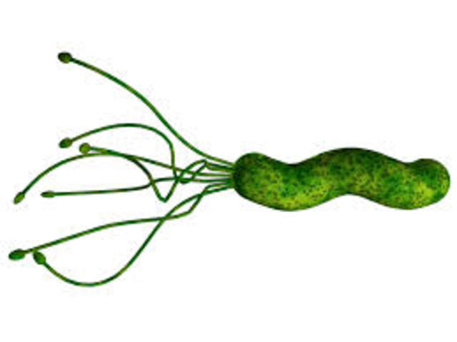 Helicobacter pylori en la úlcera de estómago.