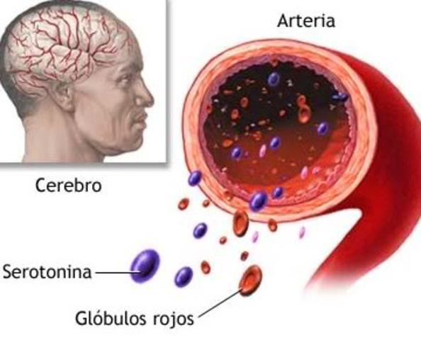 Benjamín Rush (1745-1813)