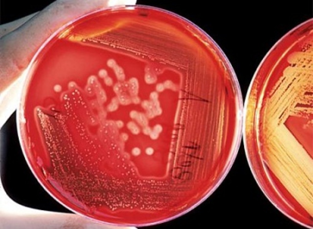 Método de Enriquecimiento de Cultivos.