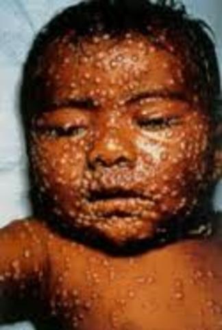 (1º enfermedad en conseguir este galardón)