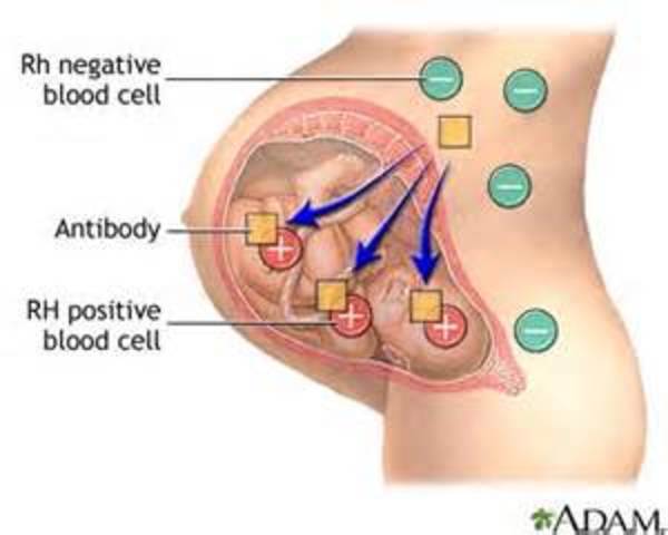 Rh Blood