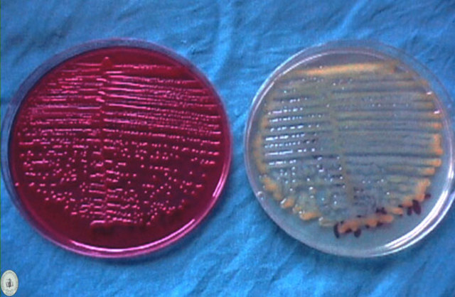 PERIODO DE LA FISIOLOGÍA MICROBIANA (1910-1940)