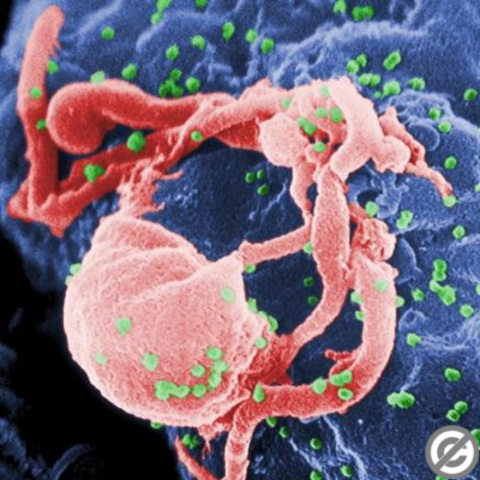 AIDS Virus