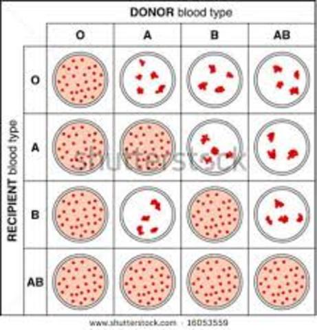 First transfusion using cross matching