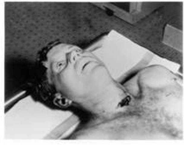 THIS IS WHEN JFK IN THE ALL TOPSEE