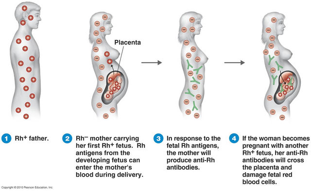 Karl Landsteiner and Alexander Wiener