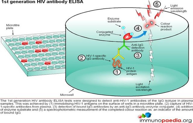 ELISA Test