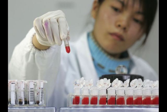 Tests that screen for indirect evidence of hepatitis