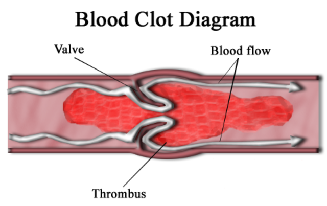 Blood clotting