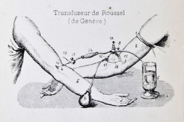 First RECORDED human-to-human blood transfusion
