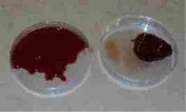 Sodium citrate plevents blood clots