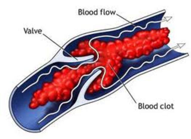 first drawings of of vein valves