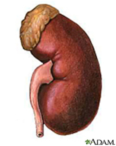 Kidney Transplant