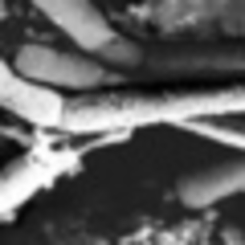 Teoría del germen de la enfermedad