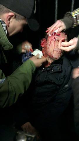 в жестоком столкновении с милицией пострадали люди, в том числе депутаты, журналисты и случайные прохожие