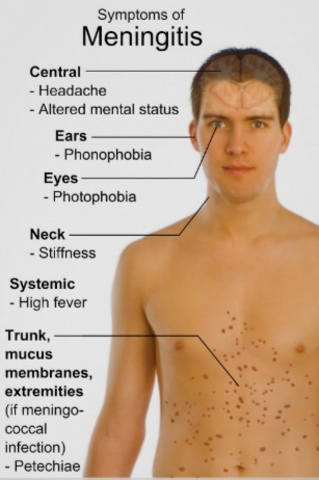 First Vaccine for Meningitis