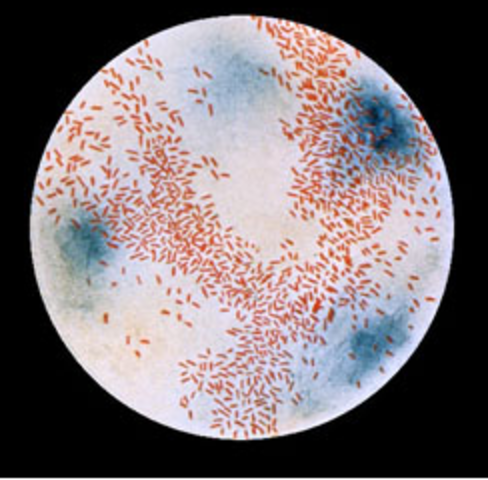 First Vaccine for Haemophilus Influenzae Type B (HiB)