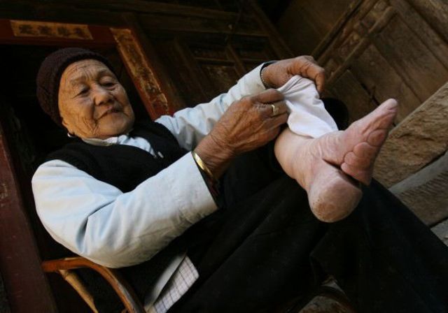 Foot Binding-abolished!
