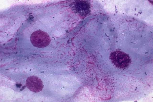 "Cells" and microorganisms