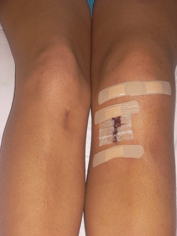 7.3- Major Life Event