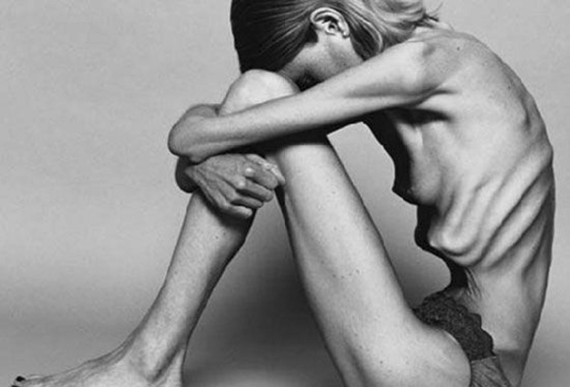 anorexia comenzo en la edad media (476-1492)