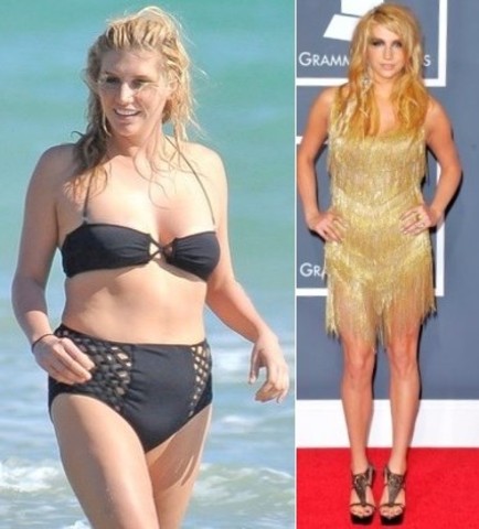 Kesha Checks Into Rehab