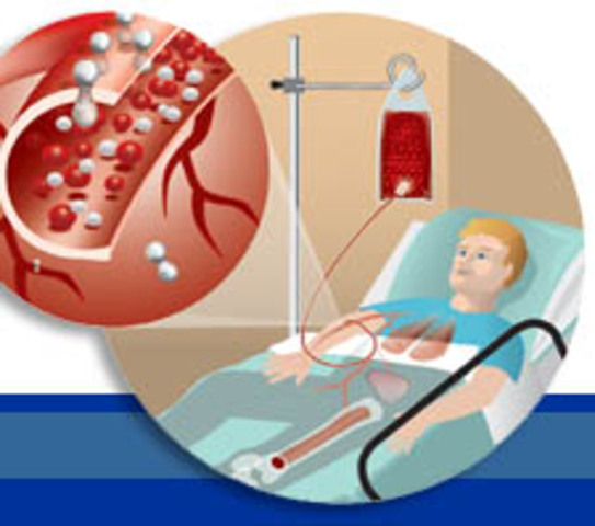 Transfusión de sangre