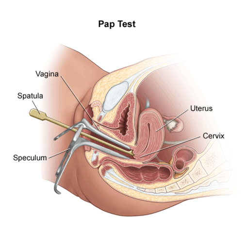 Cervical Cancer-Pap Test