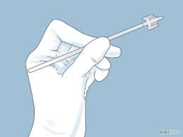 Cervical Cancer-HPV Test