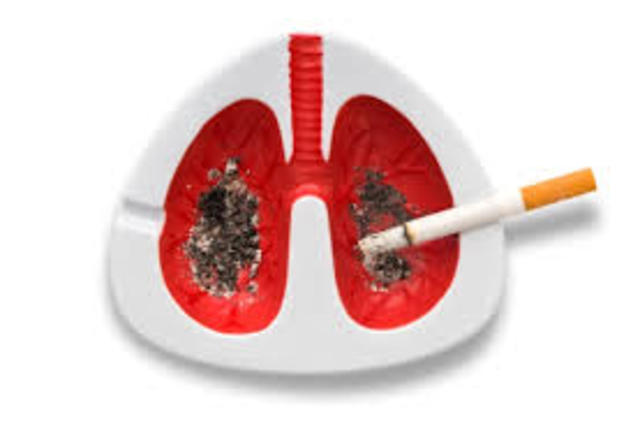Lung Cancer
