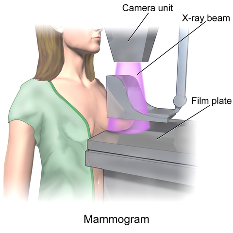 Mammogram