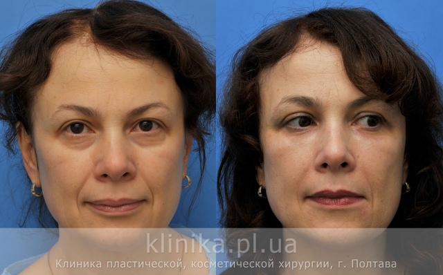 Клиника пластической и косметической хирургии Полтавы